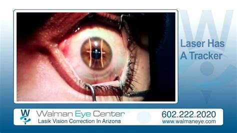 LASIK in Phoenix AZ